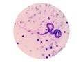 Microscopic examination of stained blood films used to differentiate microfilariae.