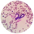 Microscopic examination of stained blood films used to differentiate microfilariae. Royalty Free Stock Photo