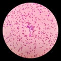 Microscopic examination of stained blood films used to differentiate microfilariae.