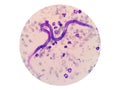 Microscopic examination of stained blood films used to differentiate microfilariae.