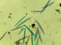 Microscopic Field of Crescent-Shaped Green Algae (Closterium) Filament Royalty Free Stock Photo