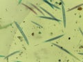 Microscopic Field of Crescent-Shaped Green Algae (Closterium) Filament Royalty Free Stock Photo