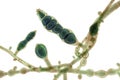 Microscopic fungi Microsporum audouinii, 3D illustration