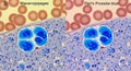 Microscopic image comparing two staining techniques, Maceropipages and Perl\'s Prussian blue, Royalty Free Stock Photo