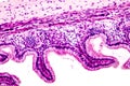 Microscopic image showing epithelium of urinary bladder Royalty Free Stock Photo