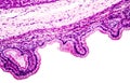 Microscopic image showing epithelium of urinary bladder Royalty Free Stock Photo