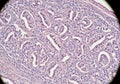 Microscopic image showing glandular tissue under Royalty Free Stock Photo