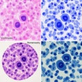 Microscopic images showing various stained blood cells, including erythrocytes, using different Royalty Free Stock Photo