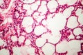 Microscopic photo showing lung tissue