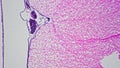 Microscopic sample Spinal cord cell TS 200x magnification tinted pink