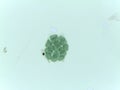 Microscopic View of the Colonial Green Alga Pandorina Royalty Free Stock Photo