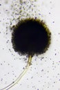 Microscopic view of a conidial head of Black mold (Aspergillus niger) with spores