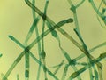 Microscopic View of the Filamentous Green Algae, Pithophora, Showing Akinet Royalty Free Stock Photo