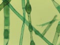Microscopic View of the Filamentous Green Algae, Pithophora, Showing Akinet Royalty Free Stock Photo