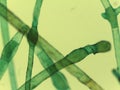 Microscopic View of the Filamentous Green Algae, Pithophora, Showing Akinet Royalty Free Stock Photo