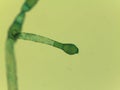 Microscopic View of the Filamentous Green Algae, Pithophora, Showing Akinet Royalty Free Stock Photo