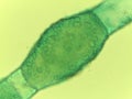Microscopic View of the Filamentous Green Algae, Pithophora, Showing Akinet Royalty Free Stock Photo