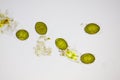 Microscopic view of freshwater green algae (Spirogyra) zygospores