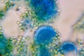 Microscopic View of a Fungal Head (Conidiophore) with Blue S Royalty Free Stock Photo