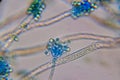 Microscopic View of a Fungal Head (Conidiophore) with Blue S Royalty Free Stock Photo