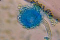 Microscopic View of a Fungal Head (Conidiophore) with Blue S Royalty Free Stock Photo