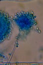 Microscopic View of a Fungal Head (Conidiophore) with Blue S Royalty Free Stock Photo