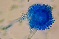 Microscopic View of a Fungal Head (Conidiophore) with Blue S Royalty Free Stock Photo