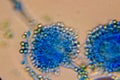 Microscopic View of a Fungal Head (Conidiophore) with Blue S Royalty Free Stock Photo