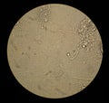 Microscopic view of the fungi Aspergillus