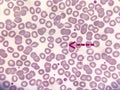 Microscopic view of hematological stained slide leucopenia