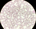 Microscopic view of hematological stained slide leucopenia