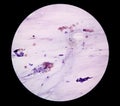 Microscopic view of Paps smear, 10x. Medical or health concept.