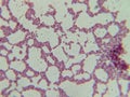Microscopic View of Purple Cocci Bacteria Clustered in Grapelike Formation Royalty Free Stock Photo