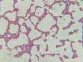 Microscopic View of Purple Cocci Bacteria Clustered in Grapelike Formation Royalty Free Stock Photo