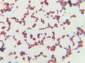 Microscopic View of Purple Cocci Bacteria Clustered in Grapelike Formation Royalty Free Stock Photo