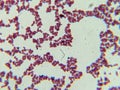 Microscopic View of Purple Cocci Bacteria Clustered in Grapelike Formation Royalty Free Stock Photo