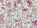 Microscopic View of Purple Cocci Bacteria Clustered in Grapelike Formation Royalty Free Stock Photo