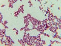 Microscopic View of Purple Cocci Bacteria Clustered in Grapelike Formation Royalty Free Stock Photo