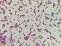 Microscopic View of Purple Cocci Bacteria Clustered in Grapelike Formation Royalty Free Stock Photo