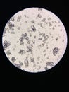 Microscopic view of struvite crystals from urinary sediment. Magnesium ammonium phospate crystals. Causing Feline Lower Urinary