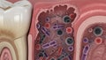 Microscopic view of bacteria and microbes inside a diseased tooth cavity and inflamed gum tissue Royalty Free Stock Photo