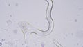 Nematode or roundworm.