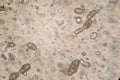 Microscopy of the Alternaria fungus macroconidia Royalty Free Stock Photo