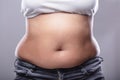 Woman With Excessive Belly Fat