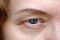middle aged female's eye with drooping eyelid doing makeup. Ptosis is a drooping of the upper eyelid, lazy eye.