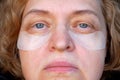 middle aged female\'s eye with drooping eyelid with patch for eyes. Ptosis is a drooping of the upper eyelid, lazy eye. C