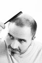 Middle-aged man concerned by hair loss Baldness alopecia close up black and white, white background Royalty Free Stock Photo