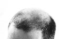 Middle-aged man concerned by hair loss Baldness alopecia close up black and white, white background Royalty Free Stock Photo