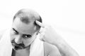 Middle-aged man concerned by hair loss Baldness alopecia close up black and white, white background Royalty Free Stock Photo