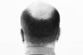 Middle-aged man concerned by hair loss Baldness alopecia close up black and white, white background Royalty Free Stock Photo